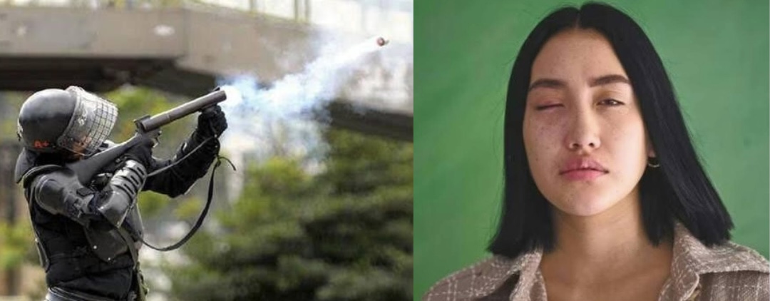 Juez condenó a siete años de cárcel al patrullero del Esmad que dejó sin un ojo a una estudiante durante las protestas de 2021